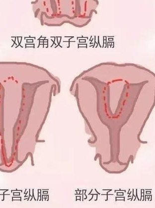 成都西囡做试管怎么样？费用高不高？